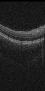 B-scan thumbnail