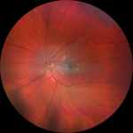 Fundus thumbnail