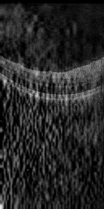 B-scan thumbnail